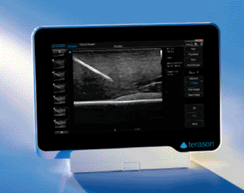 Image: The uSmart 3200T ultrasound system (Photo courtesy of Terason).